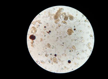 ​土壤中有哪些微生物？土壤微生物在生态系统中的作用