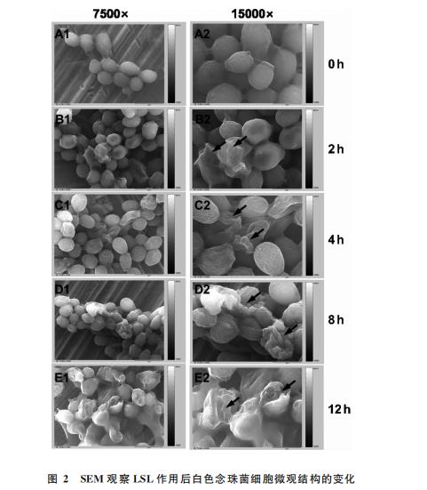 内酯型槐糖脂对白色念珠菌生长抑制和生物膜形成的影响（二）