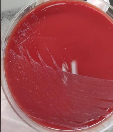 不同保存条件、培养基对淋病奈瑟菌存活率的影响——摘要、材料与方法