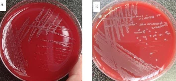 丹毒败血症:猪红斑丹毒丝菌形态、生化特征、鉴定及药敏试验——结果、讨论