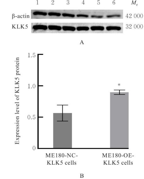 ​KLK5过表达促进宫颈癌移植瘤生长曲线并降低顺铂化疗敏感性的实验研究（一）