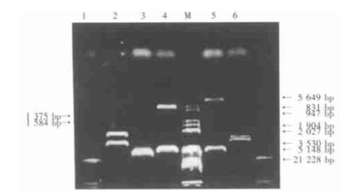 芳香化酶细胞色素P450对胶质瘤细胞生长曲线、细胞周期及分化的作用（上）