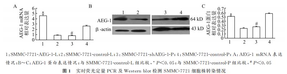 AEG-1促进肝癌生长与定向肺转移的作用与机制研究（一）