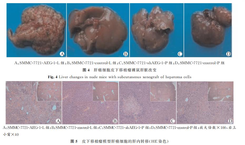 AEG-1促进肝癌生长与定向肺转移的作用与机制研究（三）