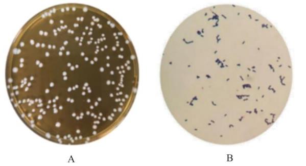 罗伊氏乳杆菌调控免疫应答抑制轮状病毒生长复制的机制研究